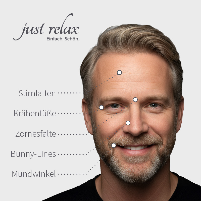 Botox Behandlungsbereiche